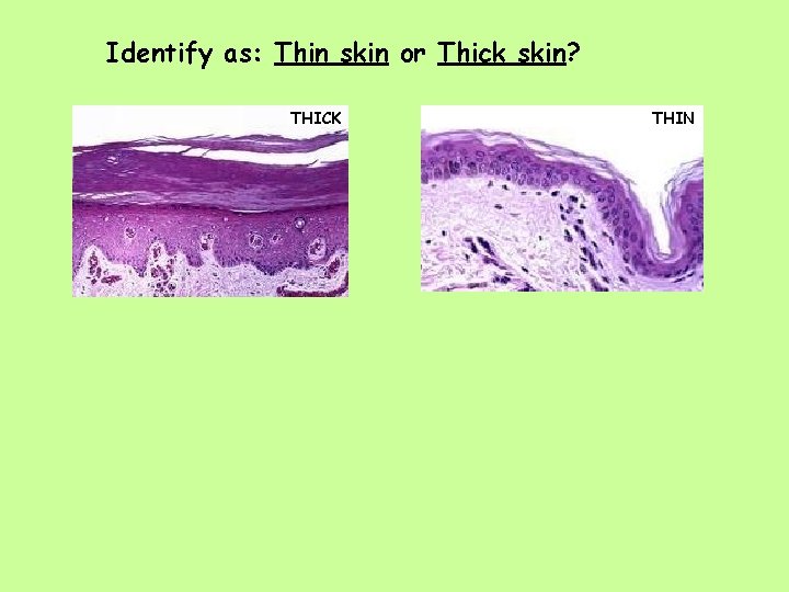 Identify as: Thin skin or Thick skin? THICK THIN 