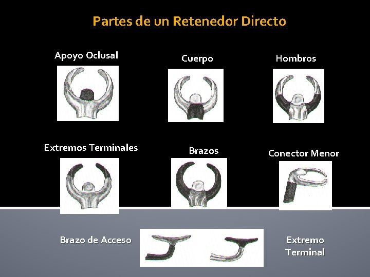 Partes de un Retenedor Directo Apoyo Oclusal Extremos Terminales Brazo de Acceso Cuerpo Brazos