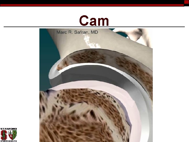 Cam 