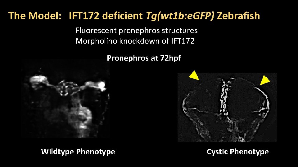 The Model: IFT 172 deficient Tg(wt 1 b: e. GFP) Zebrafish Fluorescent pronephros structures