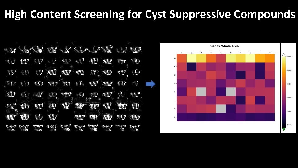 High Content Screening for Cyst Suppressive Compounds 