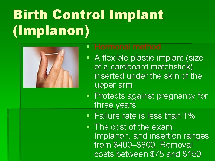 Birth Control Implant (Implanon) § Hormonal method § A flexible plastic implant (size of