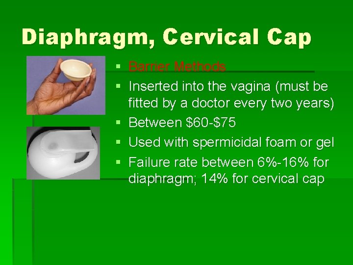 Diaphragm, Cervical Cap § Barrier Methods § Inserted into the vagina (must be fitted