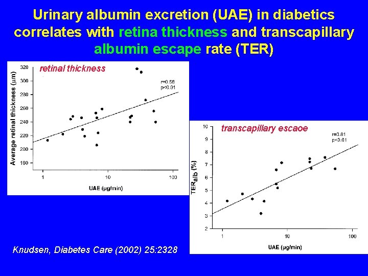 Urinary albumin excretion (UAE) in diabetics correlates with retina thickness and transcapillary albumin escape