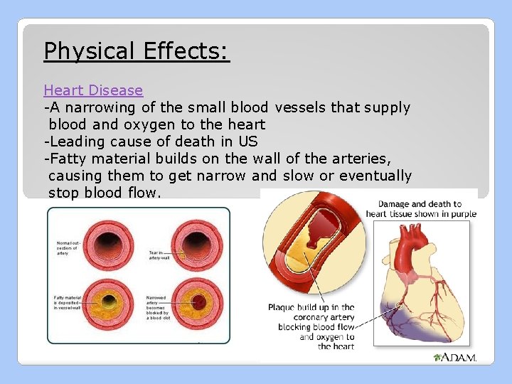 Physical Effects: Heart Disease -A narrowing of the small blood vessels that supply blood