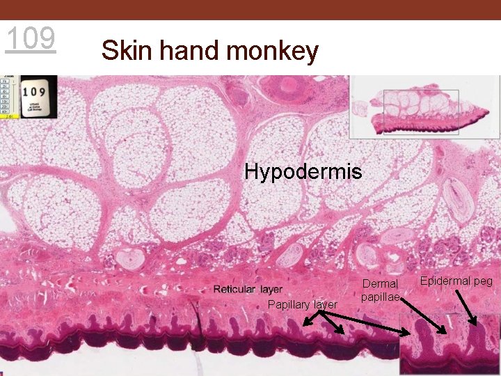 109 Skin hand monkey Hypodermis Papillary layer Dermal papillae Epidermal peg 