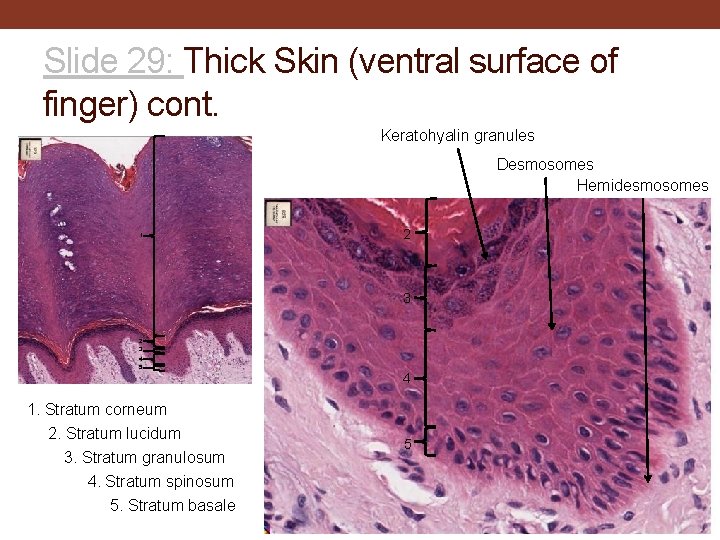 Slide 29: Thick Skin (ventral surface of finger) cont. Keratohyalin granules Desmosomes Hemidesmosomes 1