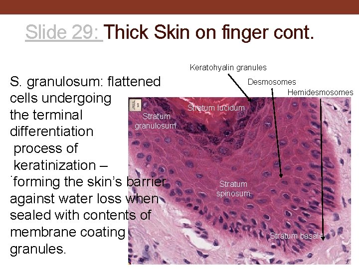 Slide 29: Thick Skin on finger cont. Keratohyalin granules S. granulosum: flattened cells undergoing