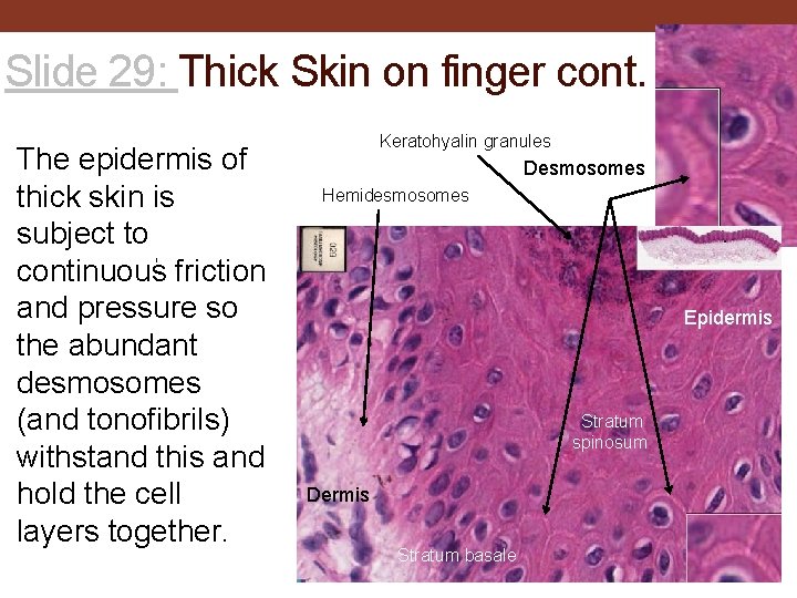 Slide 29: Thick Skin on finger cont. The epidermis of thick skin is subject