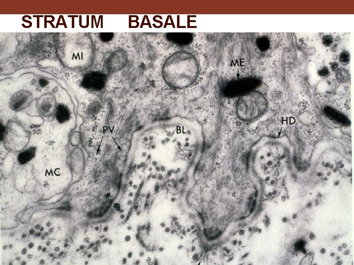 STRATUM BASALE 