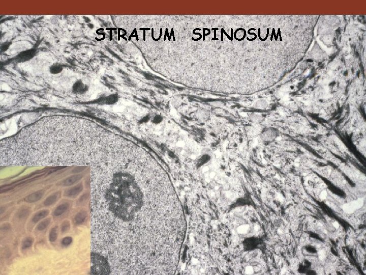 STRATUM SPINOSUM 