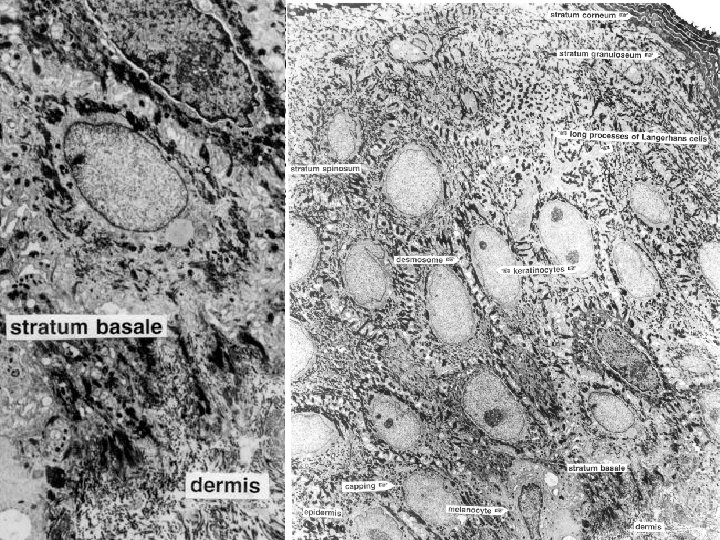 EM 8 g of skin: Note the different layers and the cellular contents of