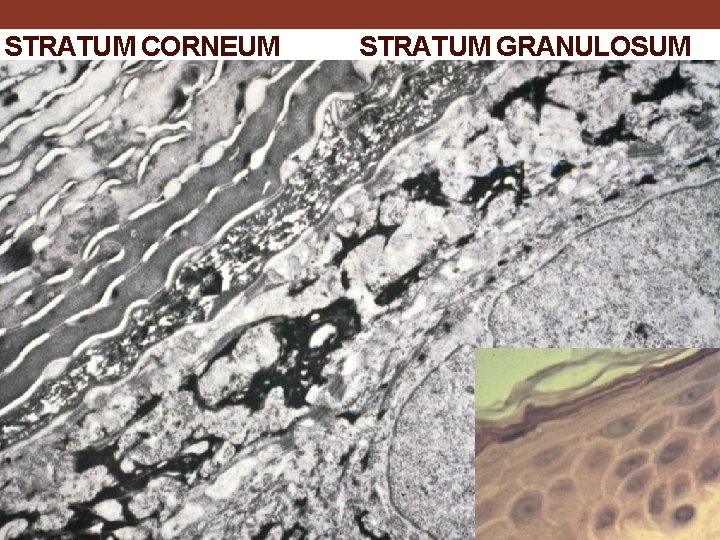 STRATUM CORNEUM STRATUM GRANULOSUM 