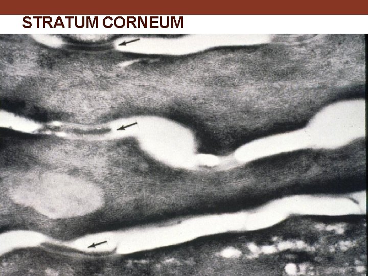 STRATUM CORNEUM 