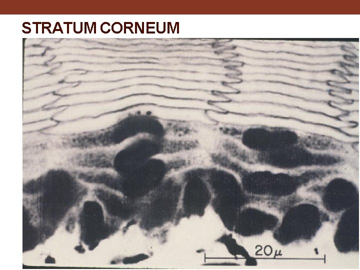 STRATUM CORNEUM 