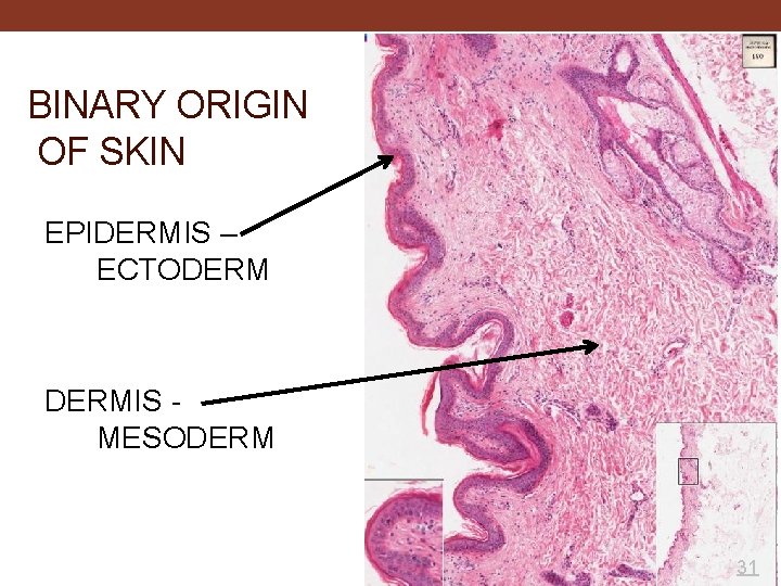 BINARY ORIGIN OF SKIN EPIDERMIS – ECTODERMIS - MESODERM 31 