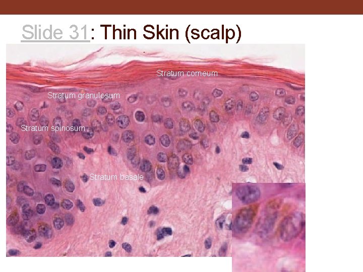 Slide 31: Thin Skin (scalp) Stratum corneum Stratum granulosum Stratum spinosum Stratum basale 