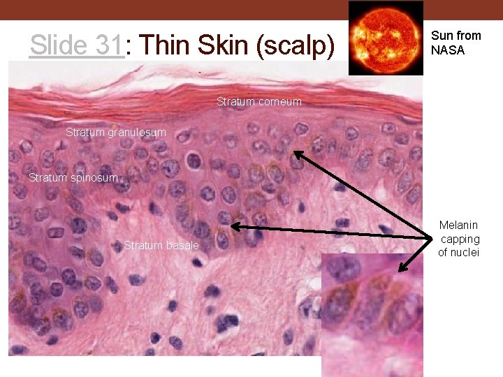 Slide 31: Thin Skin (scalp) Sun from NASA Stratum corneum Stratum granulosum Stratum spinosum