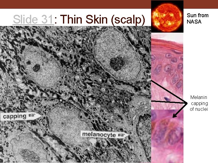 Slide 31: Thin Skin (scalp) Sun from NASA Stratum corneum Stratum granulosum Stratum spinosum