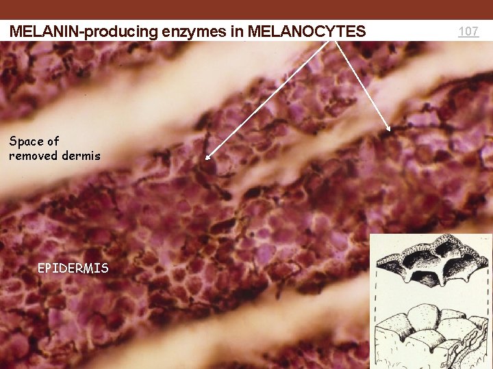 MELANIN-producing enzymes in MELANOCYTES Space of removed dermis EPIDERMIS 107 