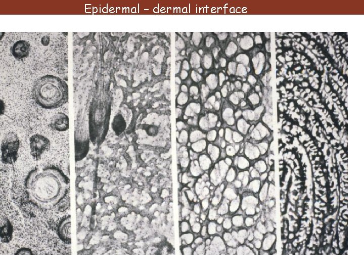 Epidermal – dermal interface trunk nipple finger 