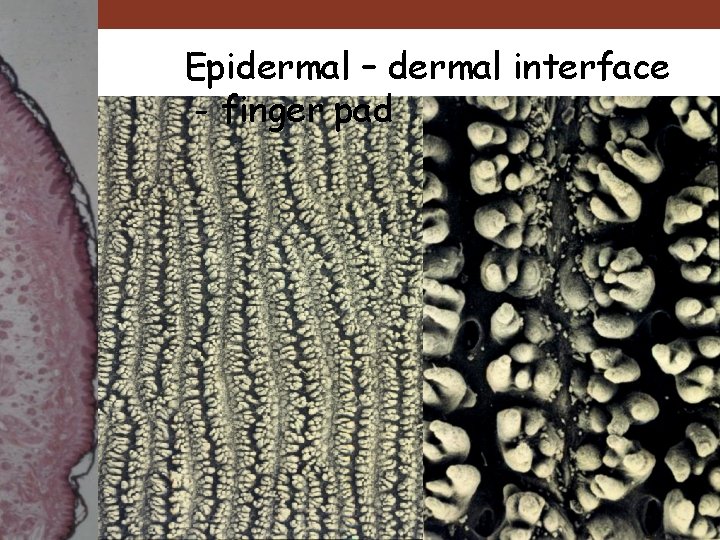 Epidermal – dermal interface - finger pad 
