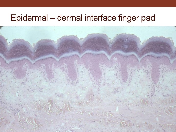 Epidermal – dermal interface finger pad 