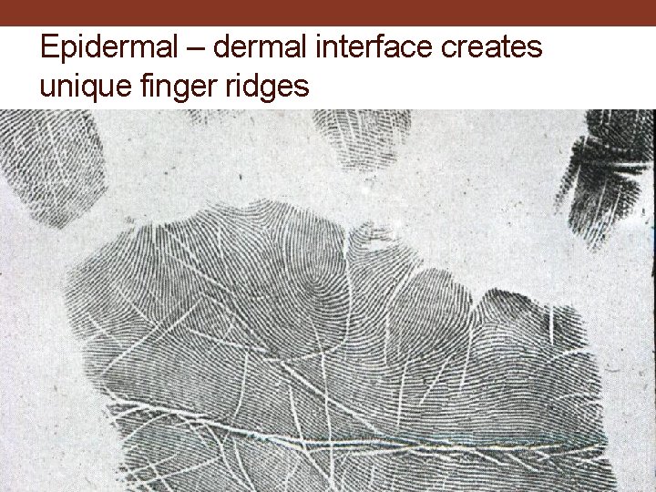 Epidermal – dermal interface creates unique finger ridges 