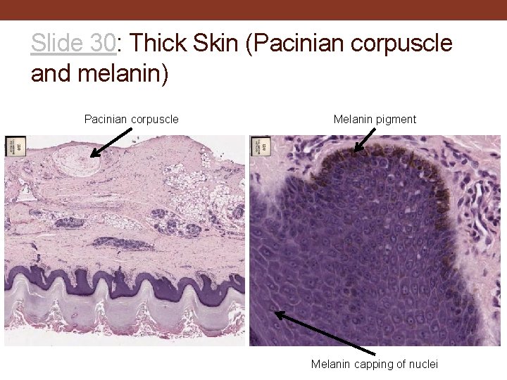 Slide 30: Thick Skin (Pacinian corpuscle and melanin) Pacinian corpuscle Melanin pigment Melanin capping