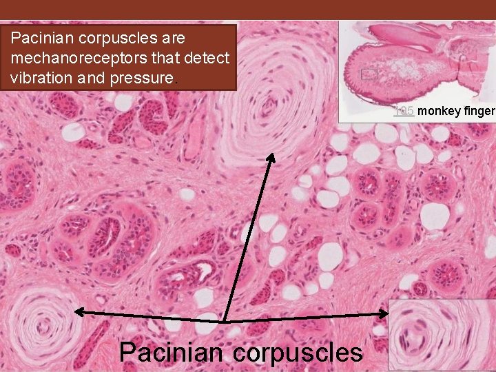 Pacinian corpuscles are mechanoreceptors that detect vibration and pressure. 105 monkey finger Pacinian corpuscles