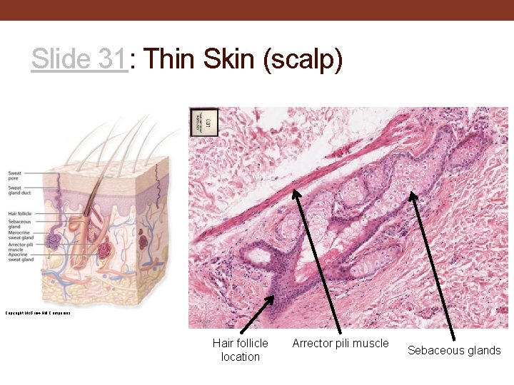 Slide 31: Thin Skin (scalp) Copyright Mc. Graw-Hill Companies Hair follicle location Arrector pili