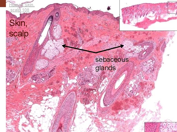 Human Skin, scalp 108 Skin, scalp sebaceous glands 