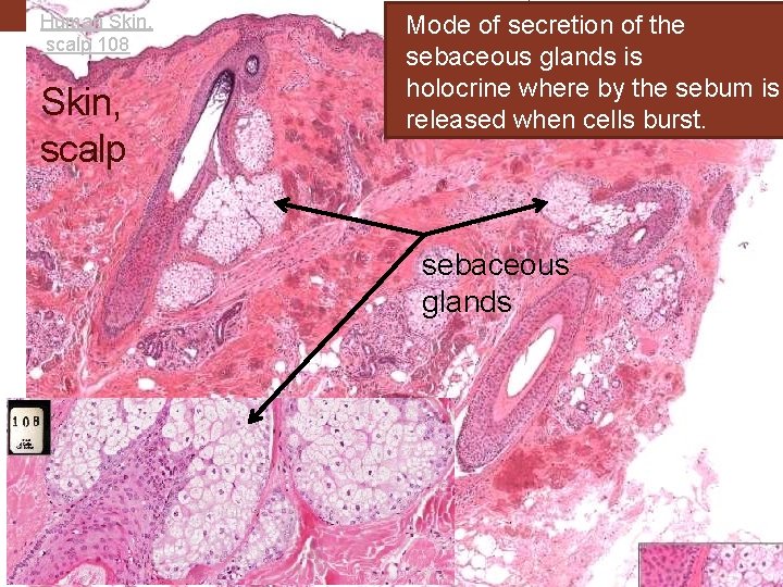 Human Skin, scalp 108 Skin, scalp Mode of secretion of the sebaceous glands is