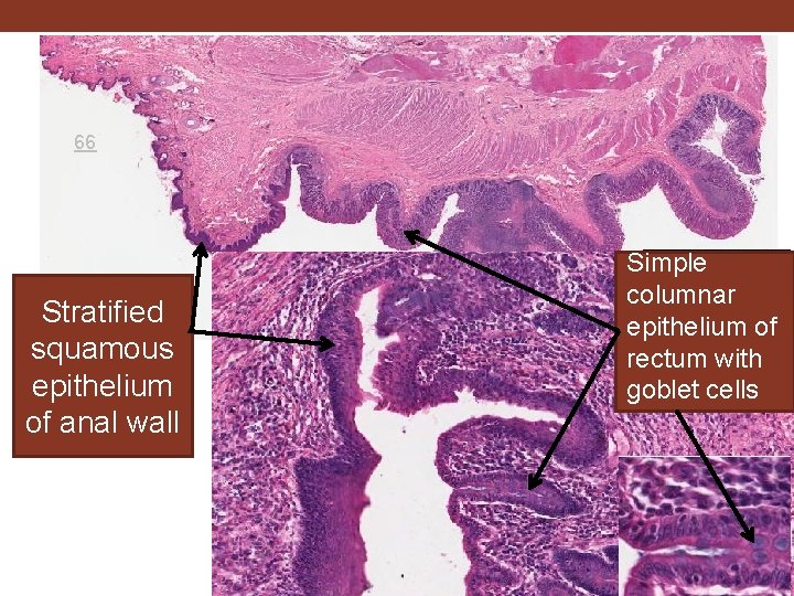 66 Stratified squamous epithelium of anal wall Simple columnar epithelium of rectum with goblet