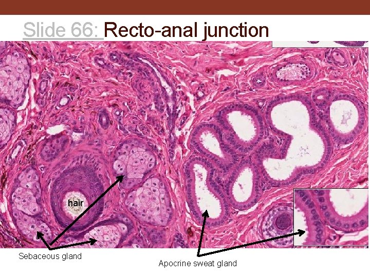 Slide 66: Recto-anal junction hair Sebaceous gland Apocrine sweat gland 