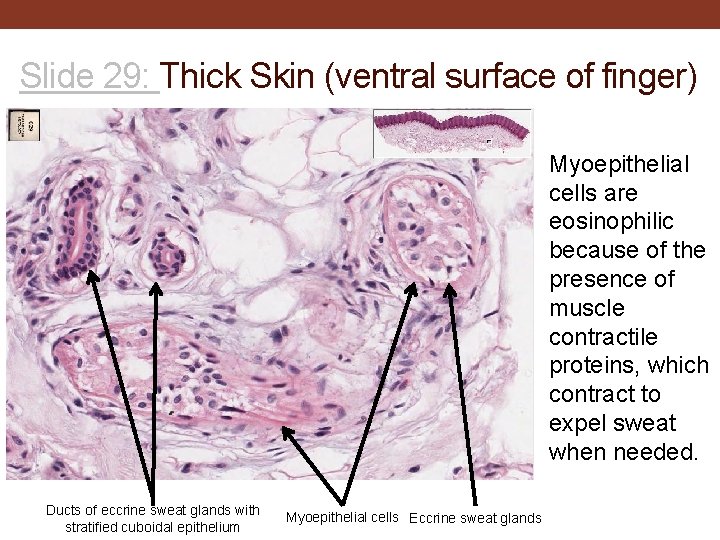 Slide 29: Thick Skin (ventral surface of finger) Myoepithelial cells are eosinophilic because of