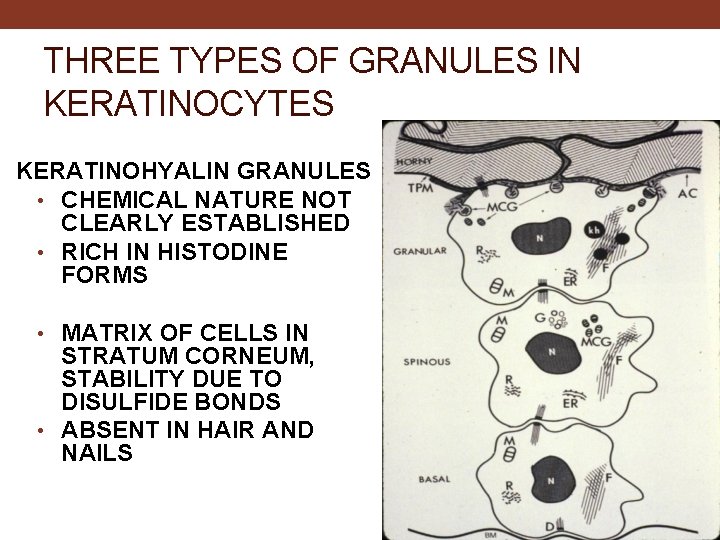 THREE TYPES OF GRANULES IN KERATINOCYTES KERATINOHYALIN GRANULES • CHEMICAL NATURE NOT CLEARLY ESTABLISHED