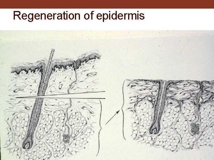 Regeneration of epidermis 