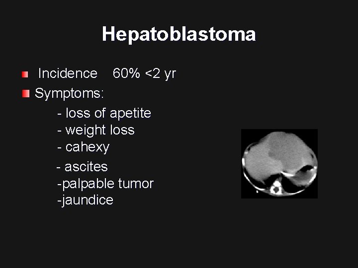 Hepatoblastoma Incidence 60% <2 yr Symptoms: - loss of apetite - weight loss -