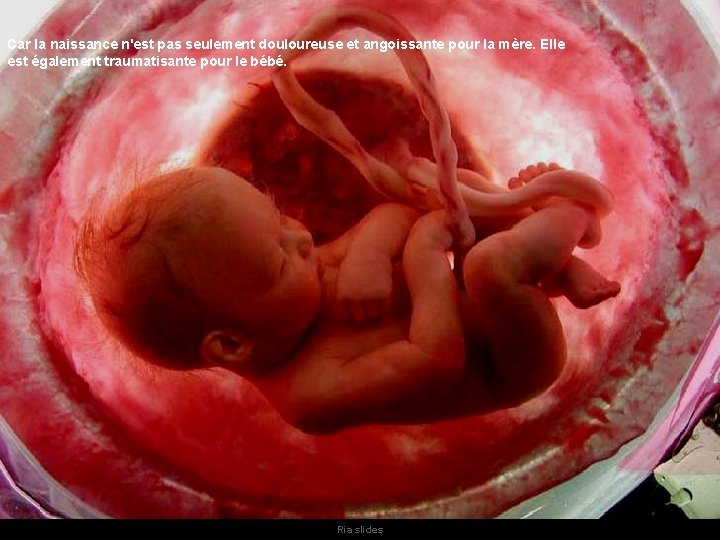 Car la naissance n'est pas seulement douloureuse et angoissante pour la mère. Elle est Car la naissance n'est pas seulement douloureuse et angoissante pour la mère. Elle est