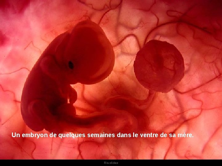 Un embryon de quelques semaines dans le ventre de sa mère. Ria slides Vue Un embryon de quelques semaines dans le ventre de sa mère. Ria slides Vue
