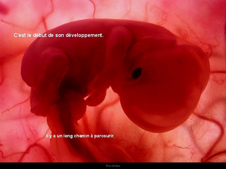 C'est le début de son développement. Il y a un long chemin à parcourir. C'est le début de son développement. Il y a un long chemin à parcourir.