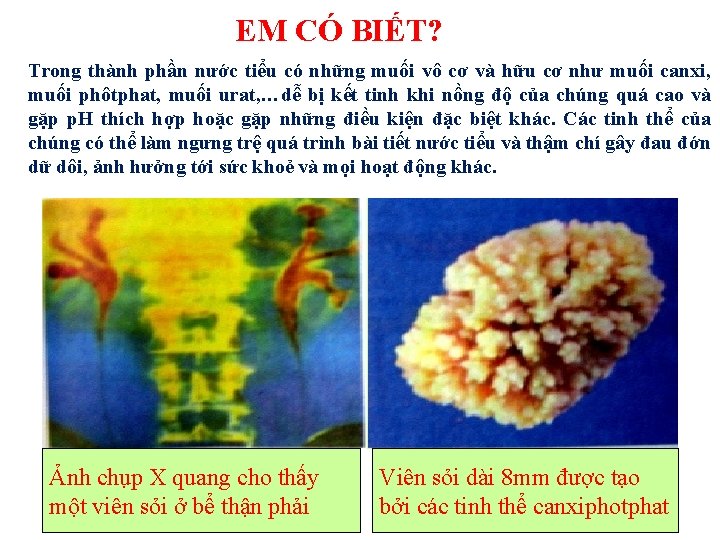 EM CÓ BIẾT? Trong thành phần nước tiểu có những muối vô cơ và