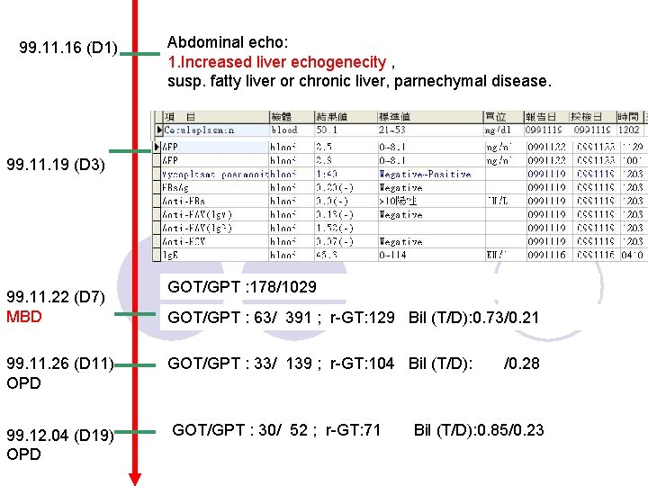 99. 11. 16 (D 1) Abdominal echo: 1. Increased liver echogenecity , susp. fatty