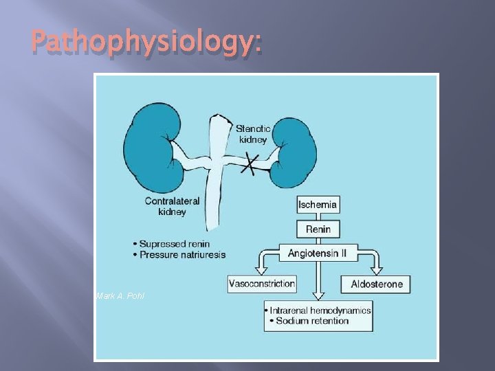 Pathophysiology: Mark A. Pohl 