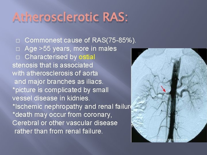 Atherosclerotic RAS: Commonest cause of RAS(75 -85%). � Age >55 years, more in males