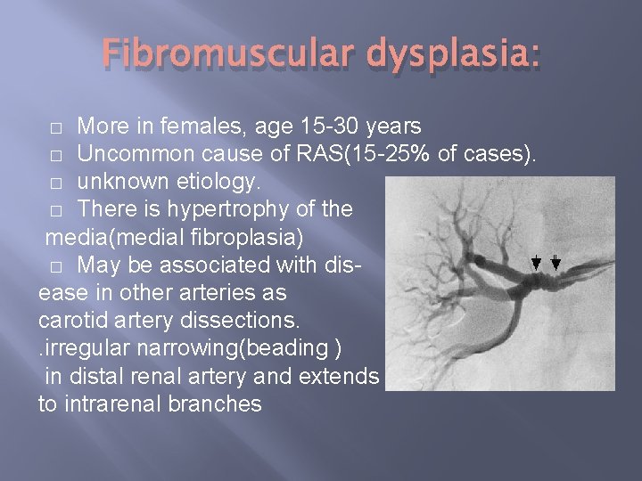 Fibromuscular dysplasia: More in females, age 15 -30 years � Uncommon cause of RAS(15