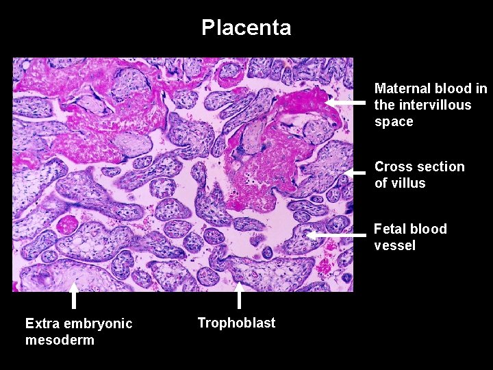 Placenta Maternal blood in the intervillous space Cross section of villus Fetal blood vessel