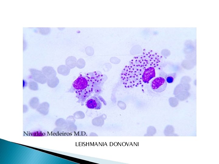 LEISHMANIA DONOVANI 