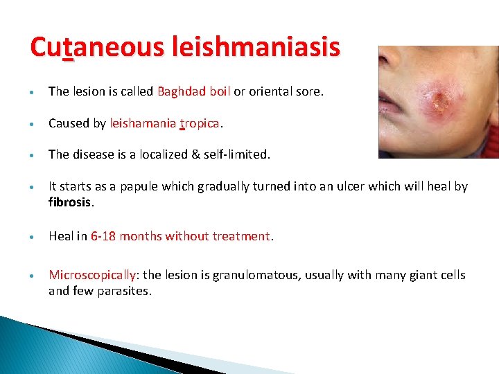 Cutaneous leishmaniasis The lesion is called Baghdad boil or oriental sore. Caused by leishamania